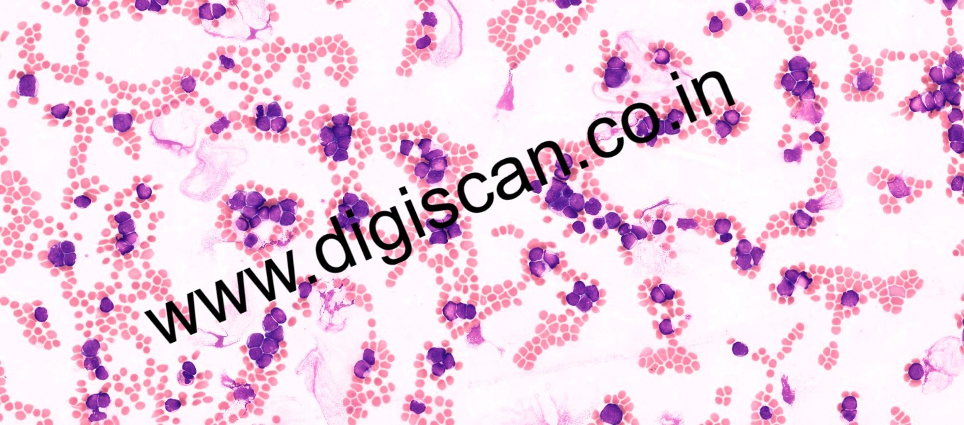 Hematology Digital Slides Set (Peripheral Blood Smear & Bone Marrow Slides)